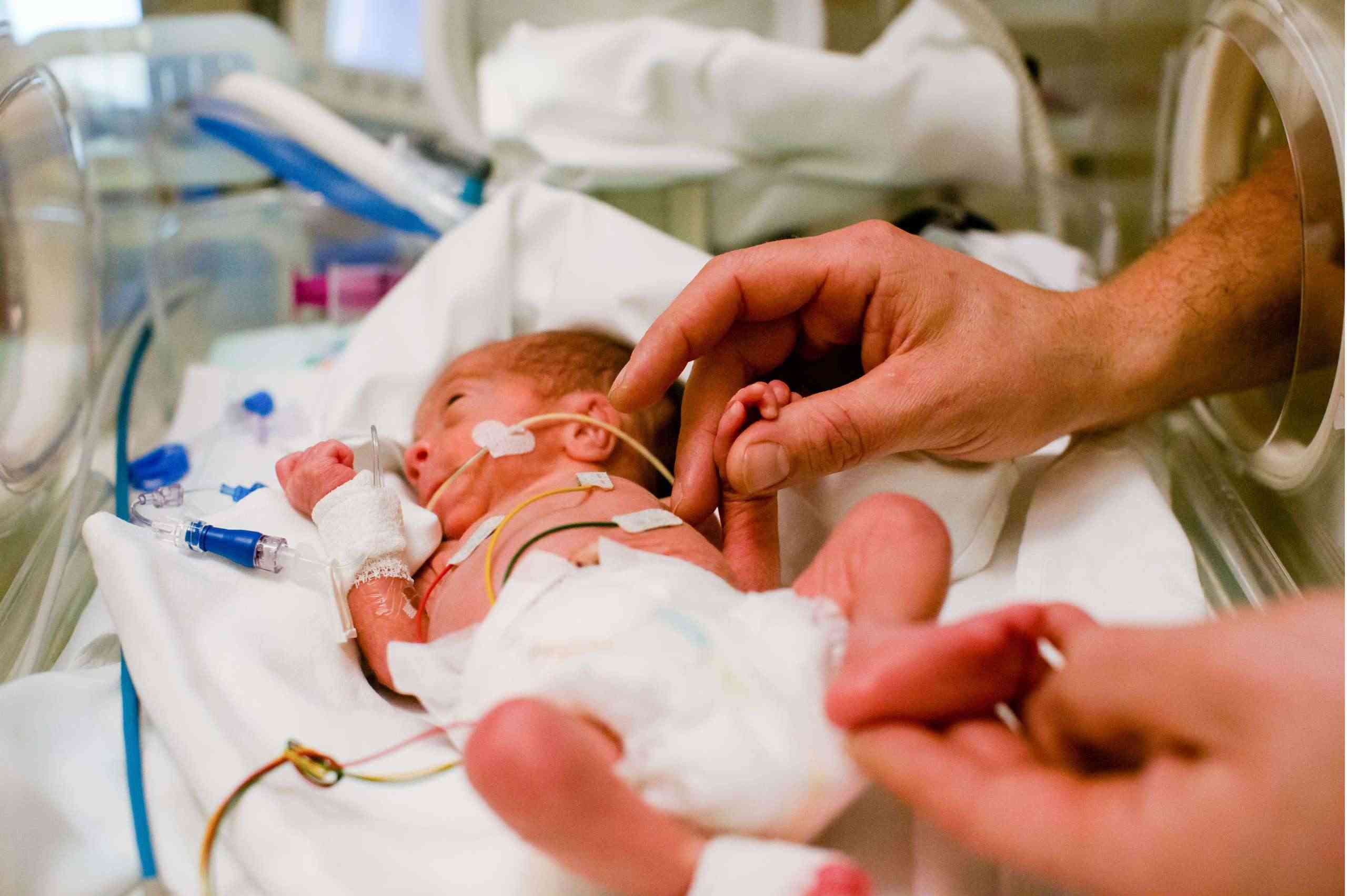 penyebab bayi lahir prematur