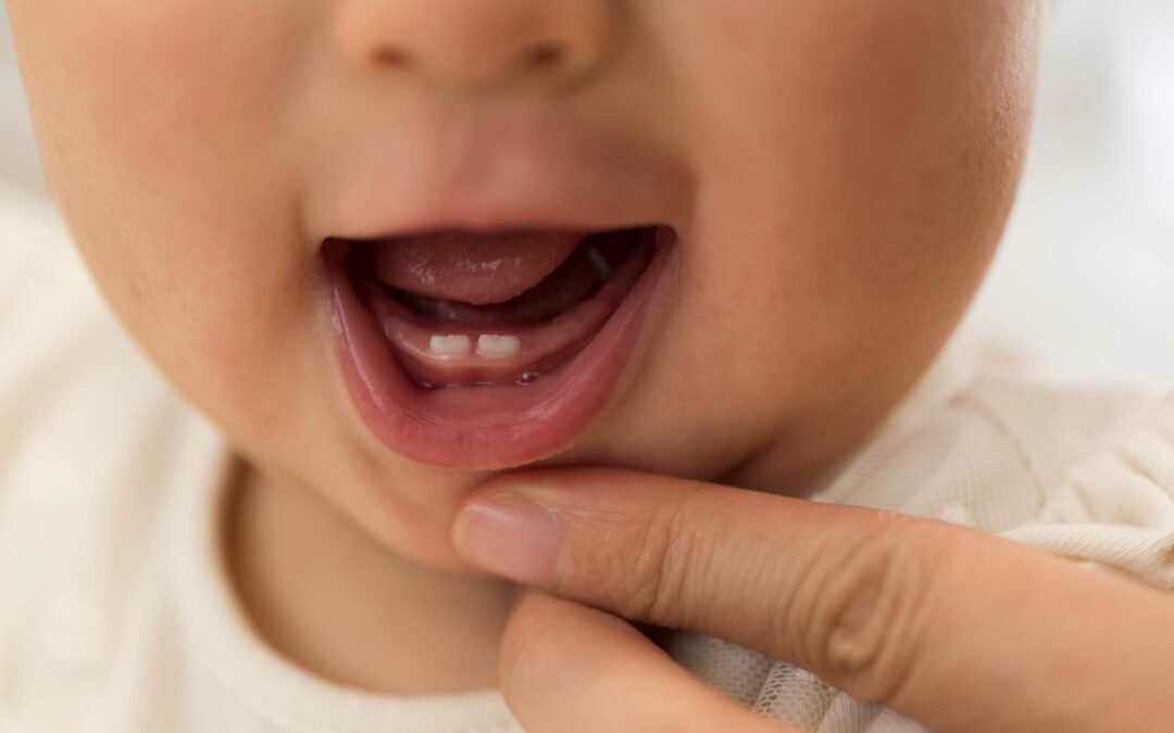 Umur Berapa Bayi Tumbuh Gigi? Simak Tahapan Tumbuh Gigi pada Bayi