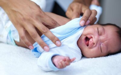 Ketahui Kelainan Kongenital pada Bayi