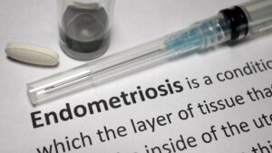 Endometriosis adalah