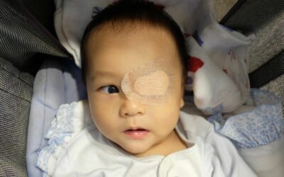 Apa Itu Retinoblastoma Anak? Ini Fakta yang Perlu Diketahui!