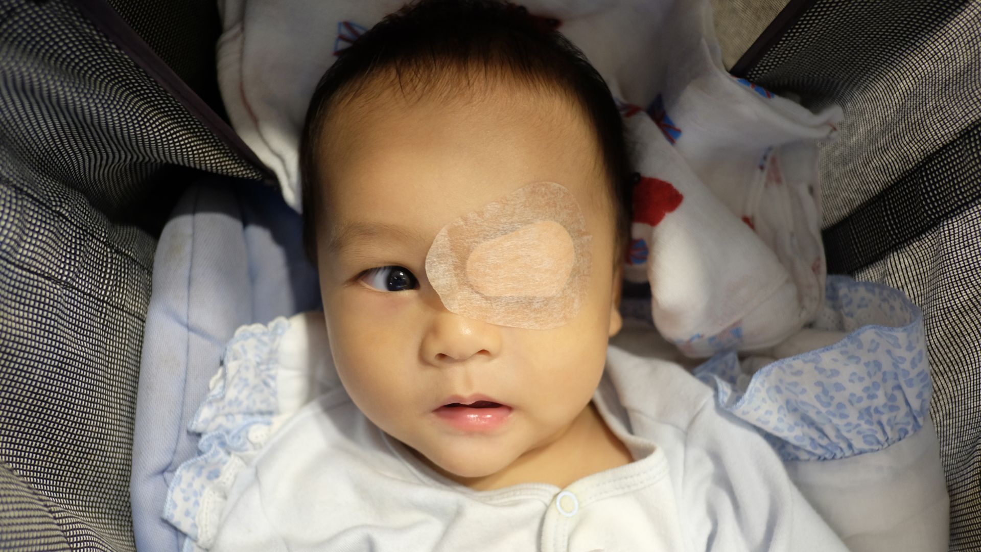 retinoblastoma