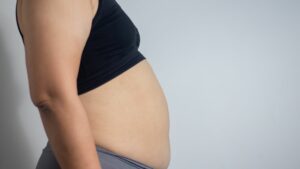 perbedaan perut buncit dan hamil