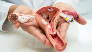 inversio uteri​