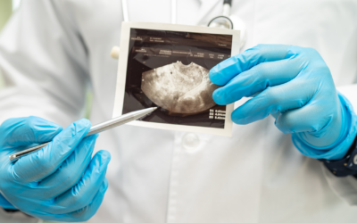 Ini yang Terjadi pada Rahim Saat Kamu Terkena Endometritis!