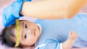bentuk kepala bayi normal​