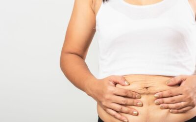 6 Cara Mengecilkan Perut Setelah Melahirkan 1 Tahun Secara Alami!
