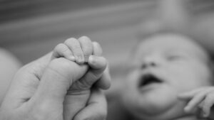 bayi hipotonia​