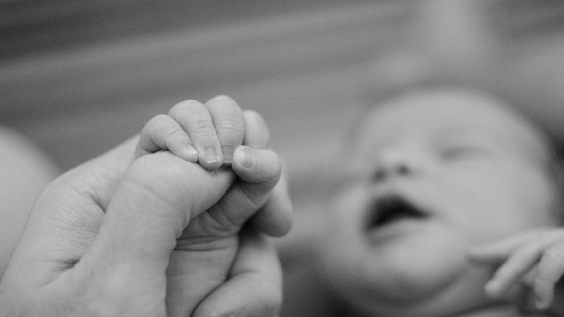 bayi hipotonia​