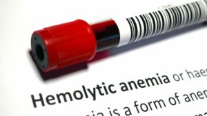 anemia hemolitik​