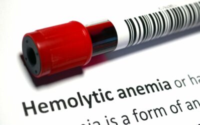 Cara Mendiagnosis dan Mengobati Anemia Hemolitik pada Bayi
