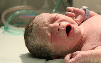 Langkah Cepat Mengatasi Sindrom Aspirasi Mekonium pada Bayi
