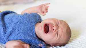 gastroschisis