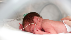 prematuritas adalah