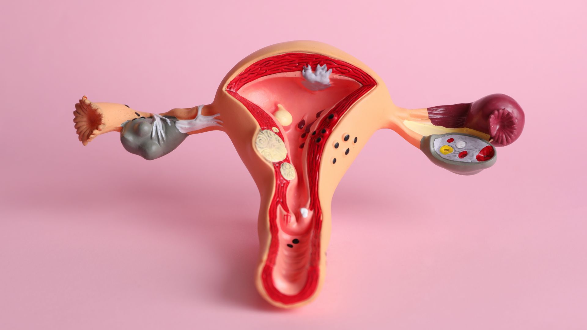 vaginismus adalah