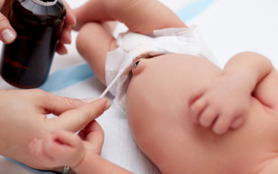 Waspada! Omfalitis pada Bayi Bisa Sebabkan Komplikasi Serius!