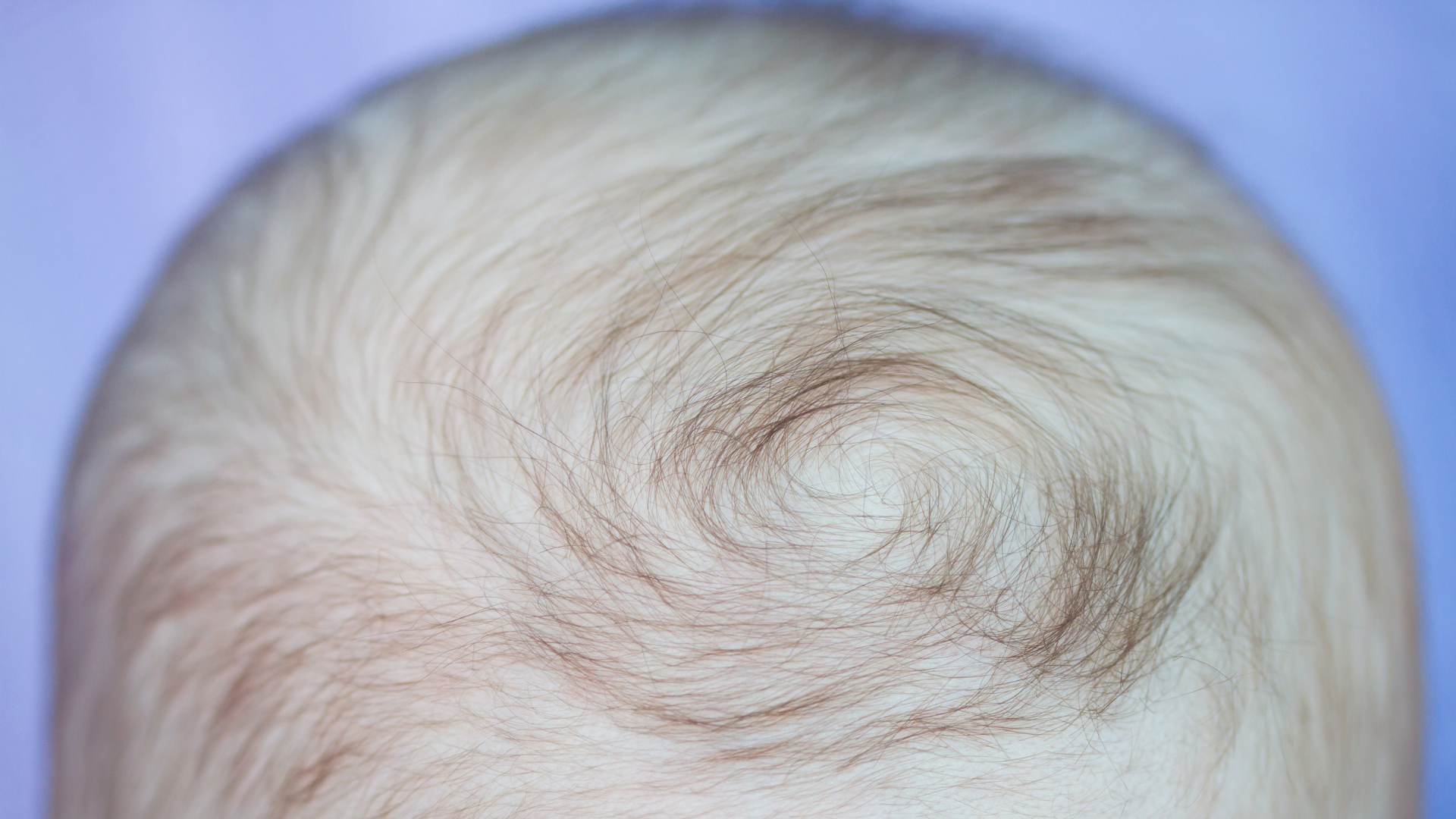 12 rambut bayi rontok