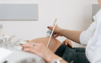 USG Berapa Kali Harus Dilakukan agar Janin Tumbuh Optimal?