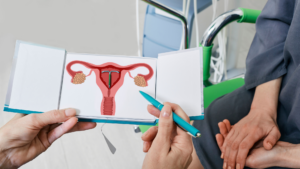 apakah kb iud bisa hamil