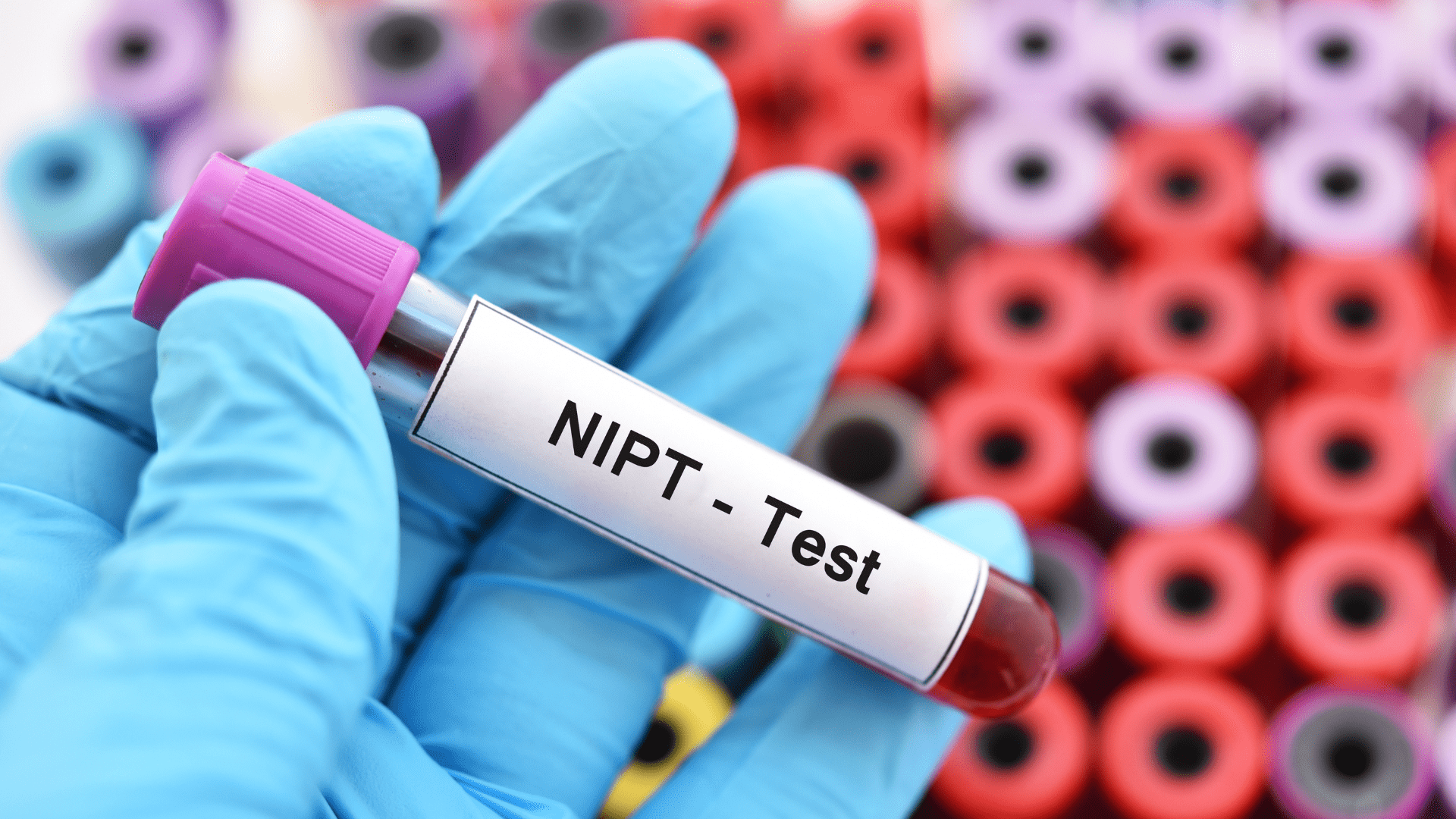 nipt adalah​