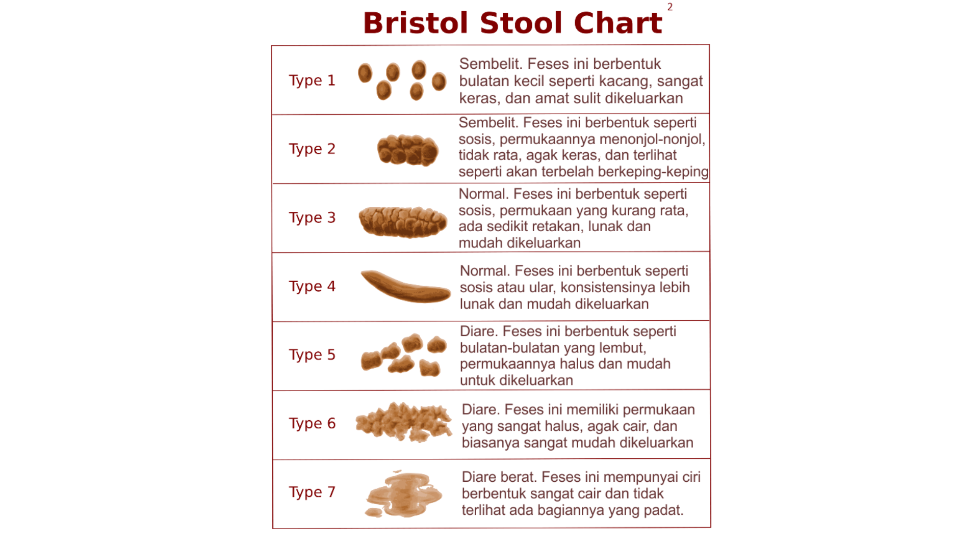 konstipasi pada bayi