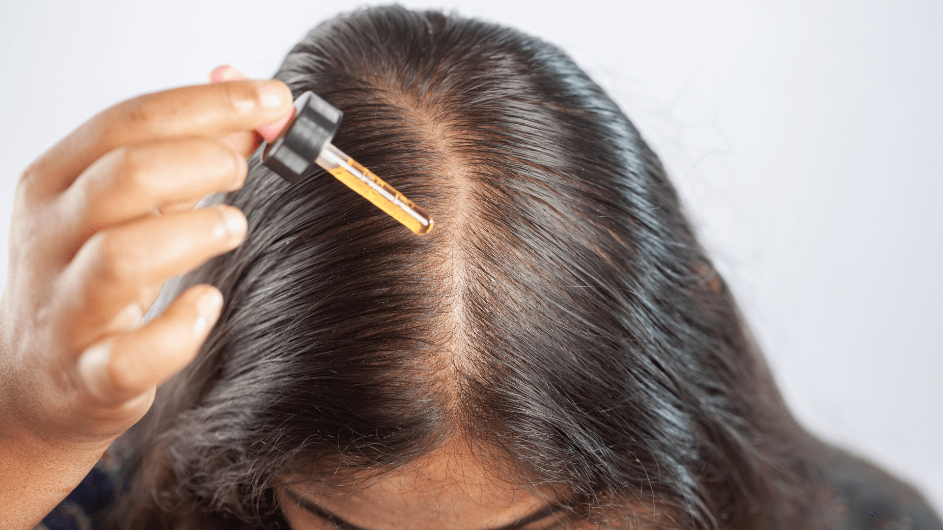 rambut rontok setelah melahirkan 