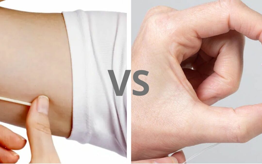 Perbandingan KB Implan dan IUD Non Hormonal: Kelebihan, Kekurangan, dan Efektivitas