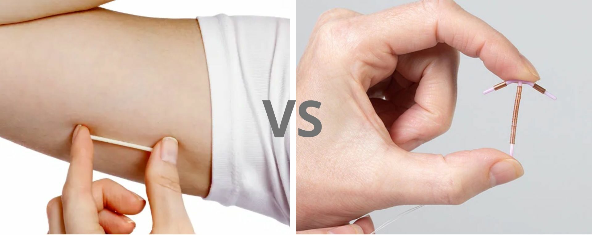 Perbandingan KB Implan vs IUD Perbandingan KB Implan vs IUD