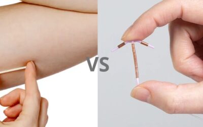 Perbandingan KB Implan dan IUD Non Hormonal: Kelebihan, Kekurangan, dan Efektivitas