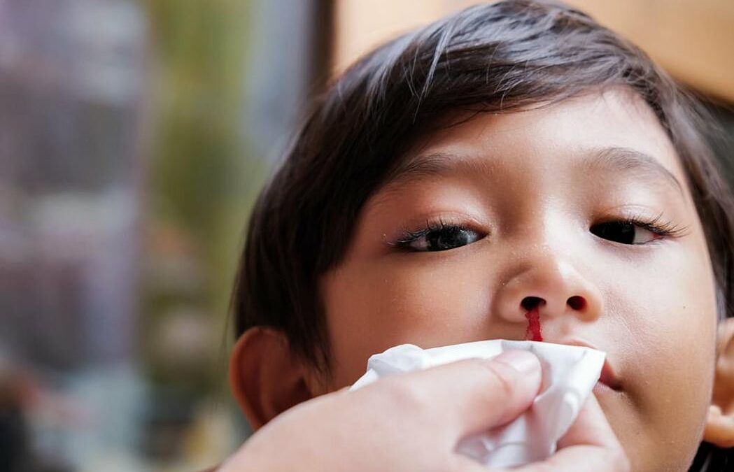 Anak Mimisan Tiba-Tiba? Ini Penyebab, Tanda, dan Cara Menanganinya
