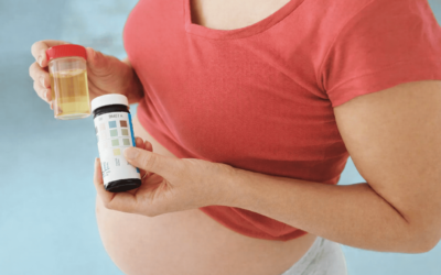 Cek Urine Ibu Hamil untuk Apa? Ini Jenis Pemeriksaan Lab yang Perlu Mommils Ketahui