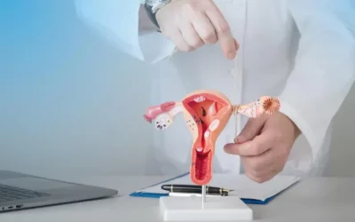 Apa Manfaat dan Risiko KB Tubektomi? Ini Penjelasan Lengkap KB Steril Wanita