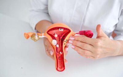 Perbedaan Adenomiosis dan Endometriosis: Gejala dan Penanganannya