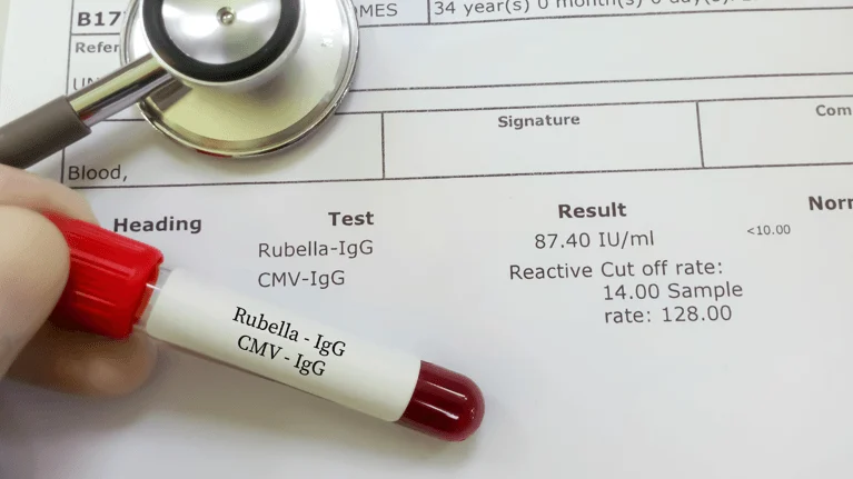 tes anti rubella IgG tes anti rubella IgG untuk ibu hamil