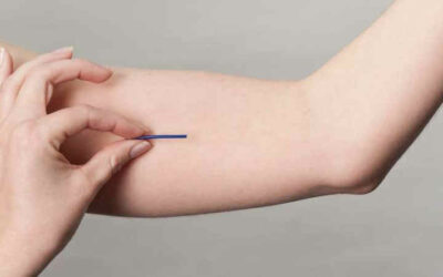 Tidak Cocok KB Implan? Ini Tanda dan Gejalanya