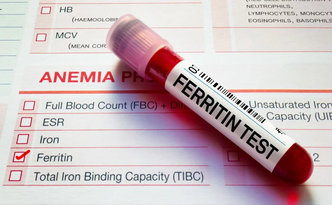 Tes Ferritin untuk Apa? Ini Fungsi, Manfaat, dan Kapan Harus Dilakukan