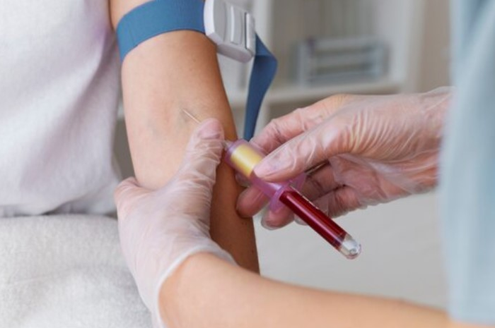 Berapa Normalnya Hb pada Anak? Ini Nilai Ideal Sesuai Usia