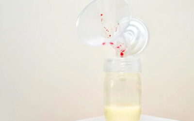 ASI Bercampur Darah saat Pumping, Apakah Aman Diminum Bayi?