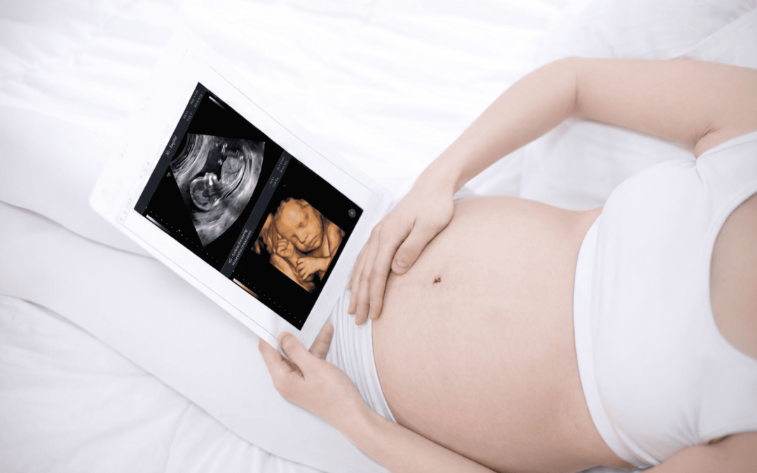 USG 2D atau 4D, Mana yang Lebih Bagus? Ini Perbedaan dan Fungsinya