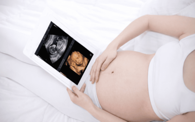 USG 2D atau 4D, Mana yang Lebih Bagus? Ini Perbedaan dan Fungsinya