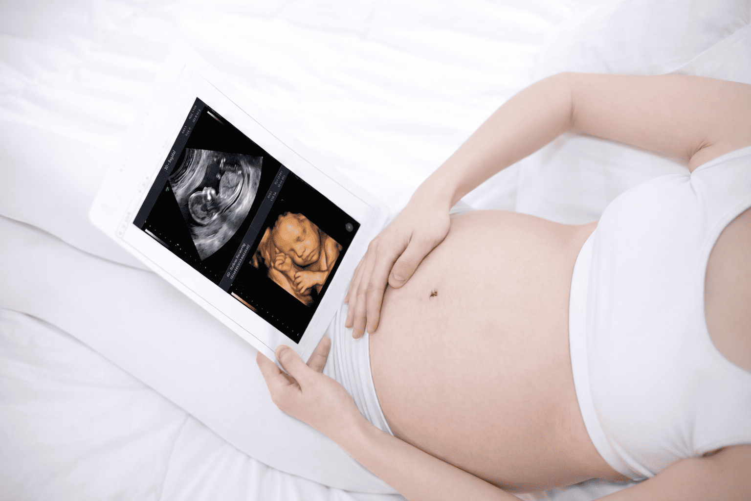 perbedaan USG 2D dan 4D