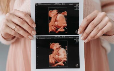 Tips Mempersiapkan Diri Sebelum USG 4D agar Janin Terlihat Jelas