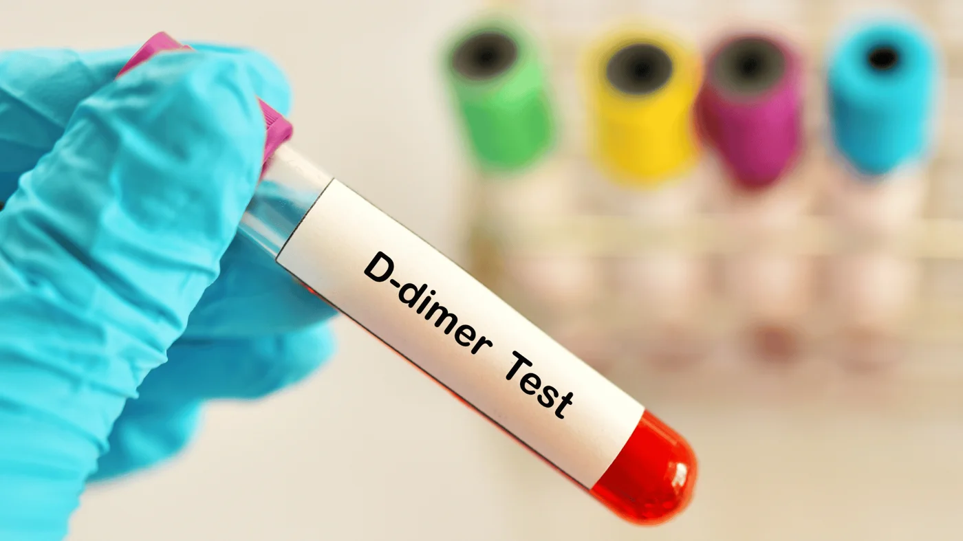 cek d dimer cek d dimer