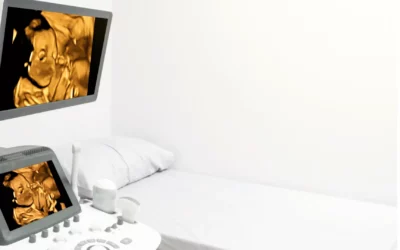 Perbedaan USG 3D dan 4D: Ini Kelebihan & Kekurangan yang Perlu Mommils Pertimbangkan