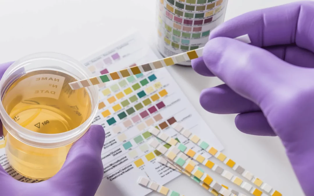 7 Hal yang Perlu Dipersiapkan Sebelum Tes Urine, Agar Hasil Lab Lebih Akurat
