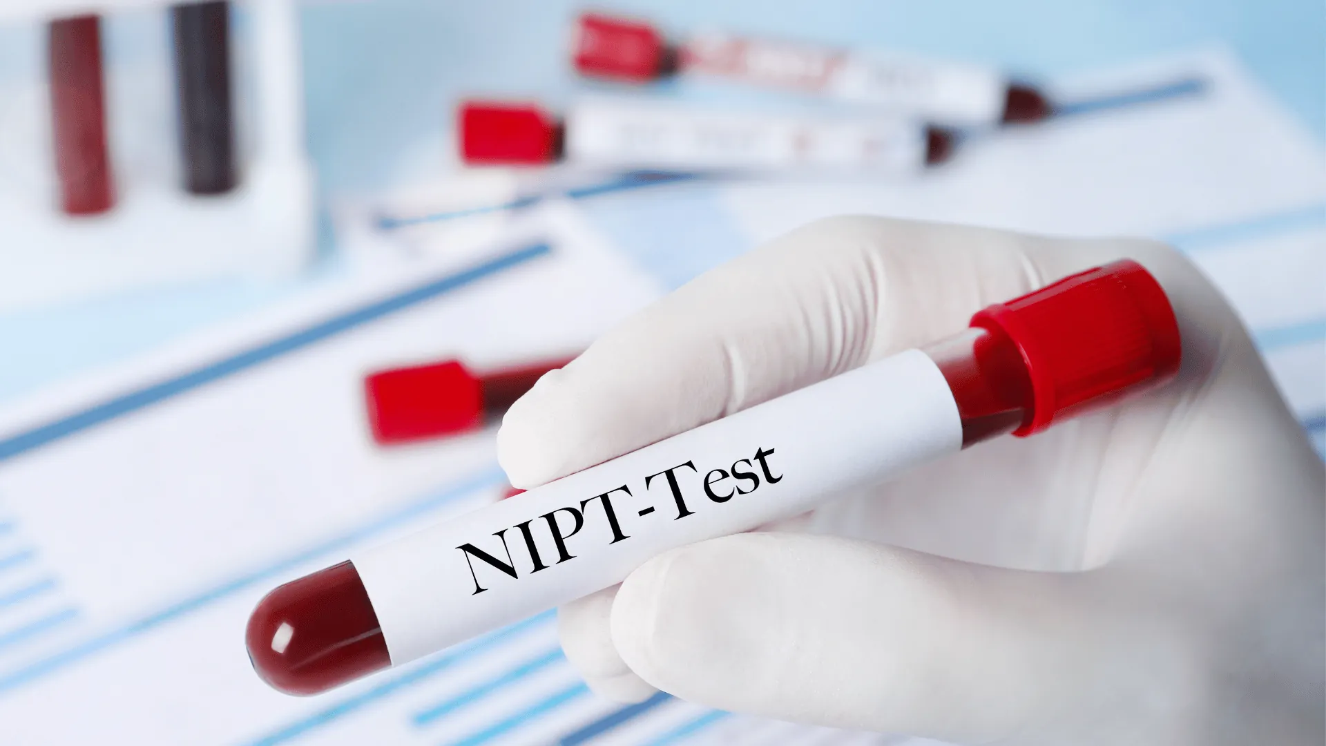 persiapan sebelum NIPT persiapan sebelum NIPT