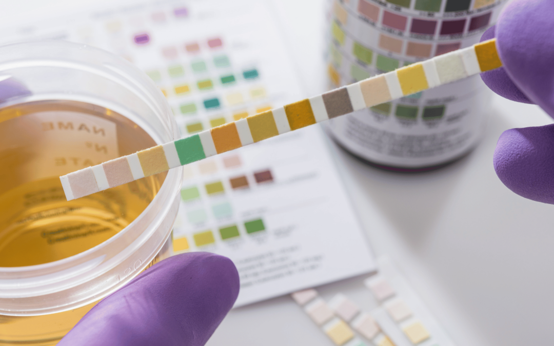 Cek Protein Urine Ibu Hamil untuk Apa? Ini Tujuan dan Manfaatnya