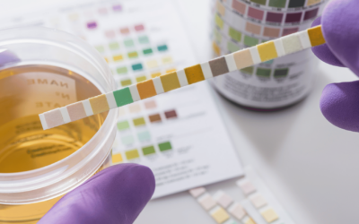 Cek Protein Urine Ibu Hamil untuk Apa? Ini Tujuan dan Manfaatnya