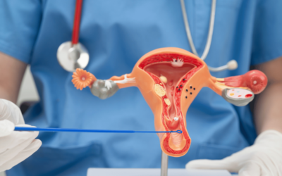 Mengenal Fibroid Rahim: Apakah Berbahaya dan Bagaimana Mengatasinya?