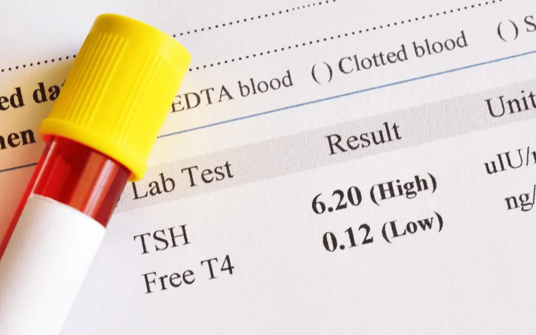 Hasil Lab Tidak Normal, Apa yang Harus Dilakukan dan Kapan Perlu ke Dokter?
